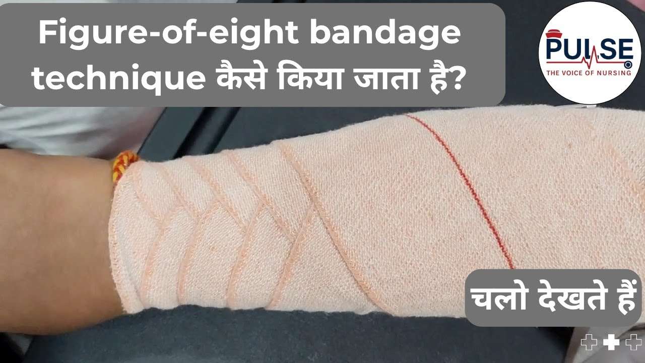 découvrez les avantages de la technique du nœud en huit, une méthode fiable et sécurisée pour assurer des fixations solides en escalade et autres activités.